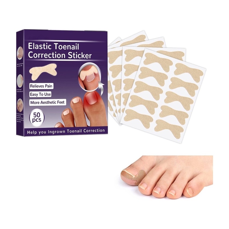 Plaaster küünte korrigeerimiseks Ldreamam, 50 tk