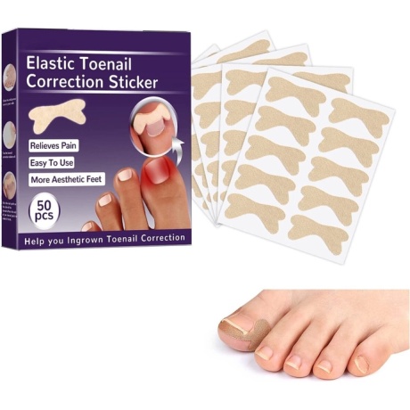 Plaaster küünte korrigeerimiseks Ldreamam, 50 tk